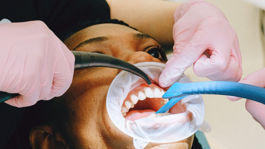 Seduta di igiene dentale professionale in corso